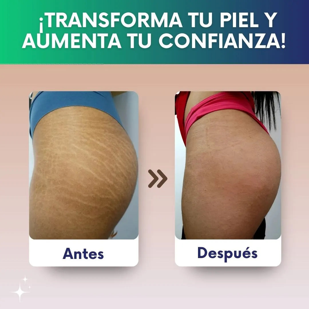 Skin Repair - Crema antiestrías con Colageno