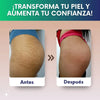 Skin Repair - Crema antiestrías con Colageno
