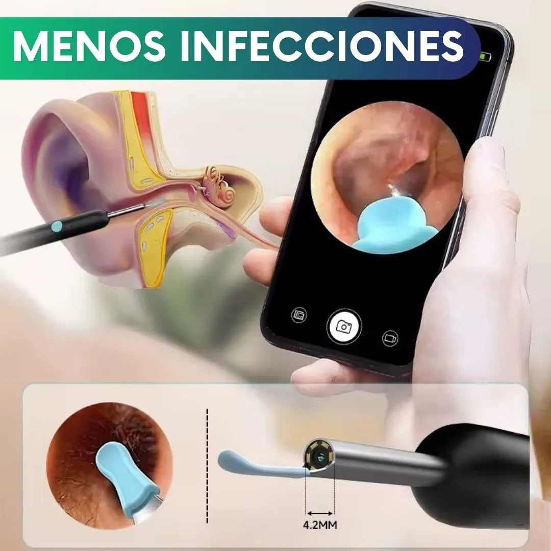 Limpiador de oídos con cámara HD
