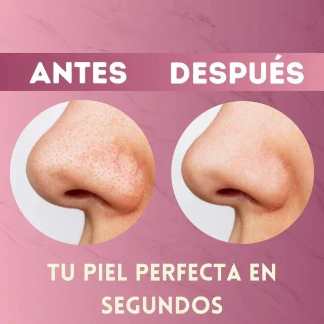 Extractor de puntos negros - Manten tu piel radiante
