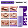 Blanqueador Dental SMILE <span style=